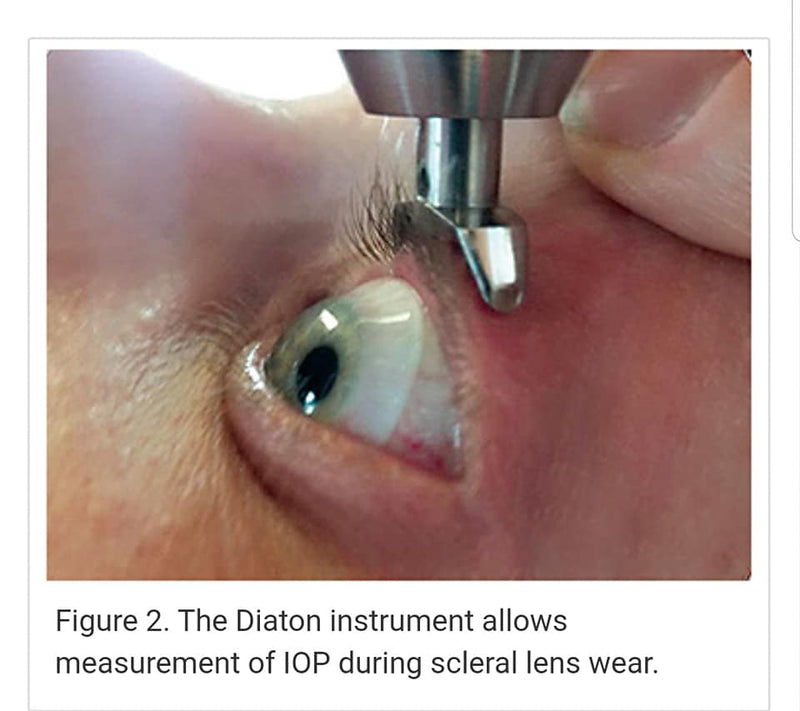Diaton IOP Tonometer- Through Eyelid and Sclera - Refurbished