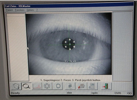 zeiss iols — models, specs & a-constants | iol... Miscellaneous – Precision Equipment
