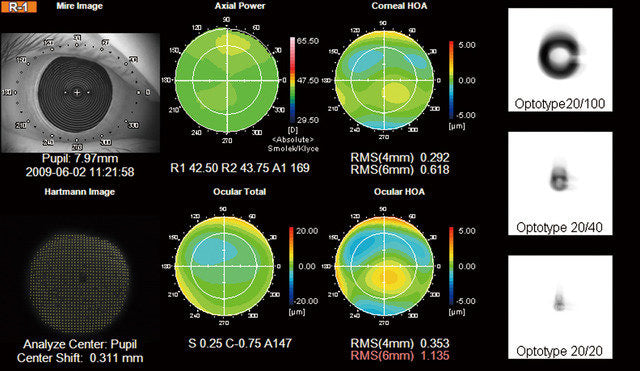 Topcon KR-1W Autorefractor Keratometry Topography 5 in 1 Wavefront